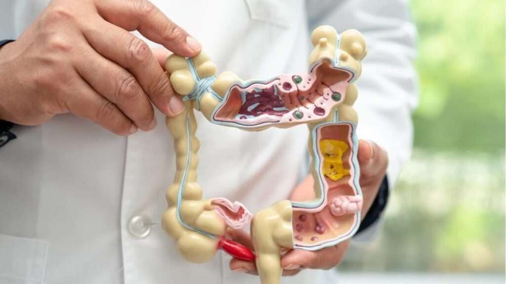 Farmacias de Madrid distribuyen más de 213,000 kits para la prevención del cáncer de colon en solo cuatro meses