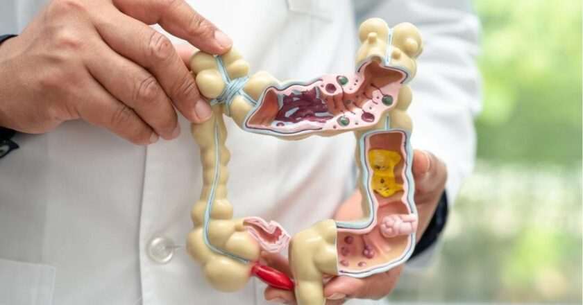 Farmacias de Madrid distribuyen más de 213,000 kits para la prevención del cáncer de colon en solo cuatro meses