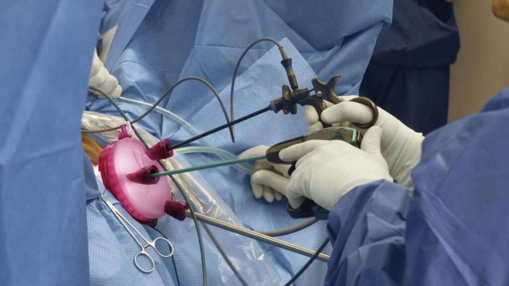 Hospital de Alcorcón: Innovadora técnica de cirugía ginecológica sin cicatrices y recuperación en solo 24 horas