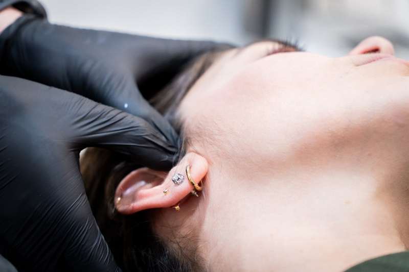 Tratamiento de ATM en CL FISIO Chamartín: fisioterapia de la articulación temporomandibular para bruxismo y cefaleas.